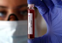 Reportan 29 contagios y un muerto por coronavirus en Jujuy
