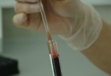Descubren que una proteína presente en los glóbulos rojos ayuda a prevenir el envejecimiento del cerebro