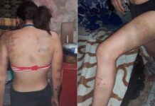 La secuestraron cuando iba a la casa de una amiga, la violaron y quemaron por seis días
